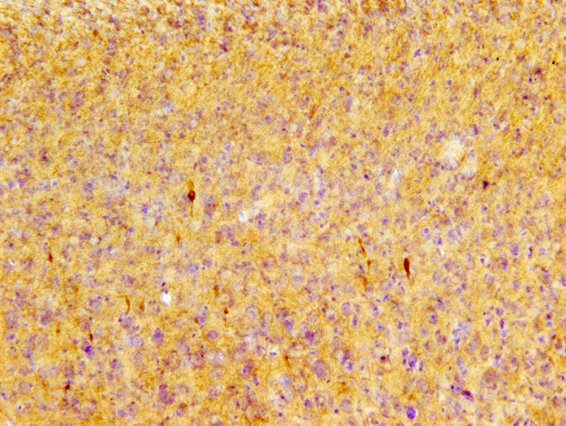 Phosphorylated tau pS422 immunoreactive profiles in the cortex of P301Smice after repetitive mild TBI. Image courtesy of Dr. Leyan Xu.