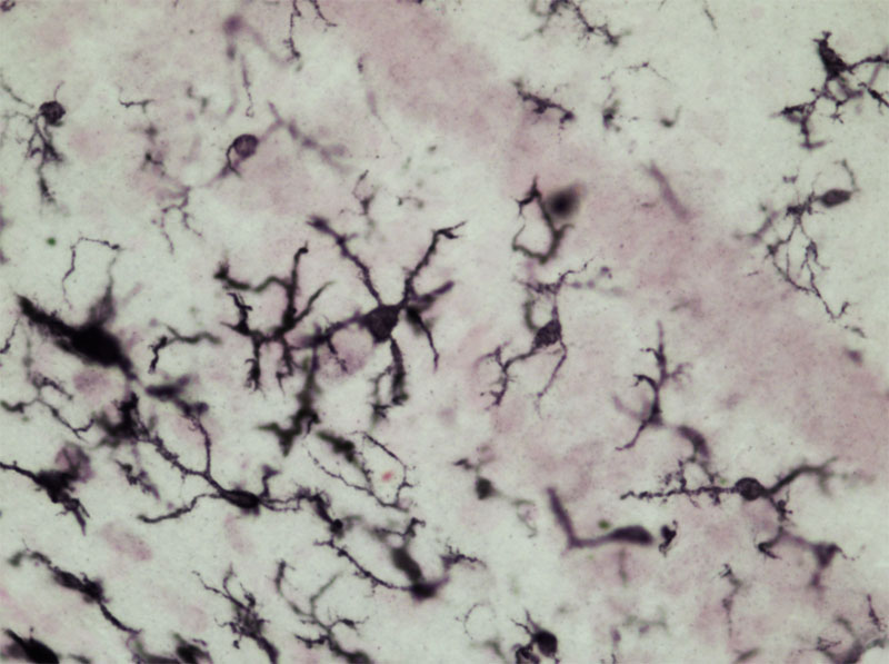 microglia_alcohol