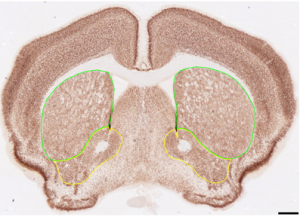 Stereologic volume estimation of the striatum (caudate putamen and nucleus accumbens) confirms changes observed using MRI volumetry in zQ175 knock-in mice.