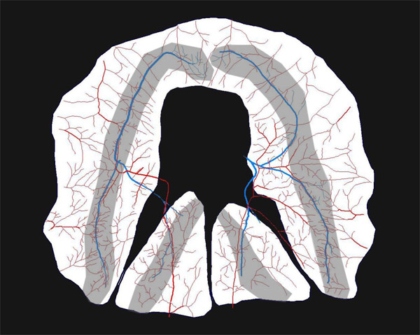 correa_segal_diaphragm