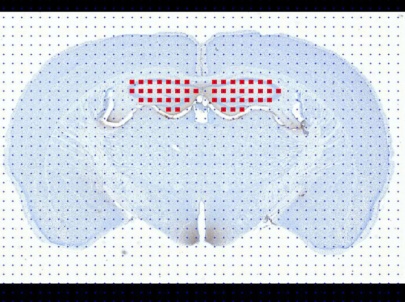 Area and Volume Estimation in Stereo Investigator