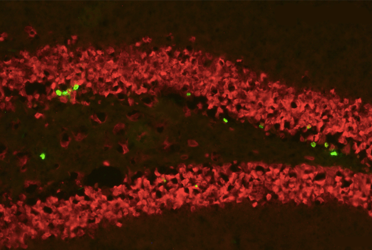 adult_neurogenesis