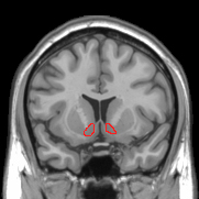 Nucleus Accumbens