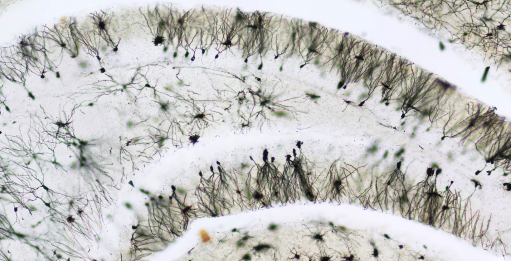 dentate granule neurons in dentate gyrus of Down syndrome mouse model