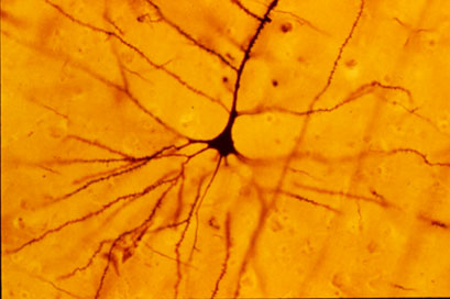 A Golgi stained human neocortical pyramidal neuron. Morris et al studied cells like this to determine the affect of sexual experience on the adult brain. Using Neurolucida, they saw shorter, less extensive dendrites in hamsters which mated during adolescence versus controls.