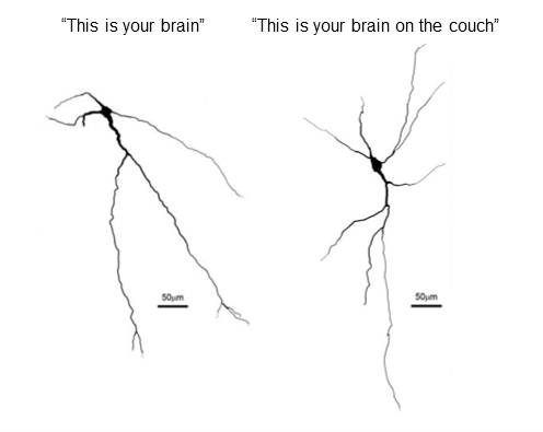 Left: A neuron from the brain of a rat that exercised for two hours each day. Right: A neuron from the brain of a sedentary rat.