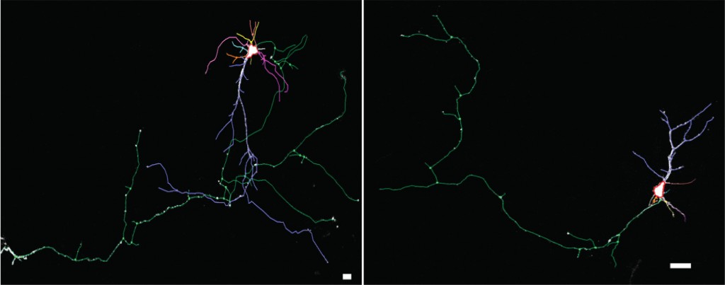 Mice with the NHE6 gene mutation show less dendritic branching. Using Neurolucida, researchers traced a GFP-labeled neuron reconstructed with confocal z stacks in a wild type mouse (left) and a mouse with a mutant NHE6 gene (right).
