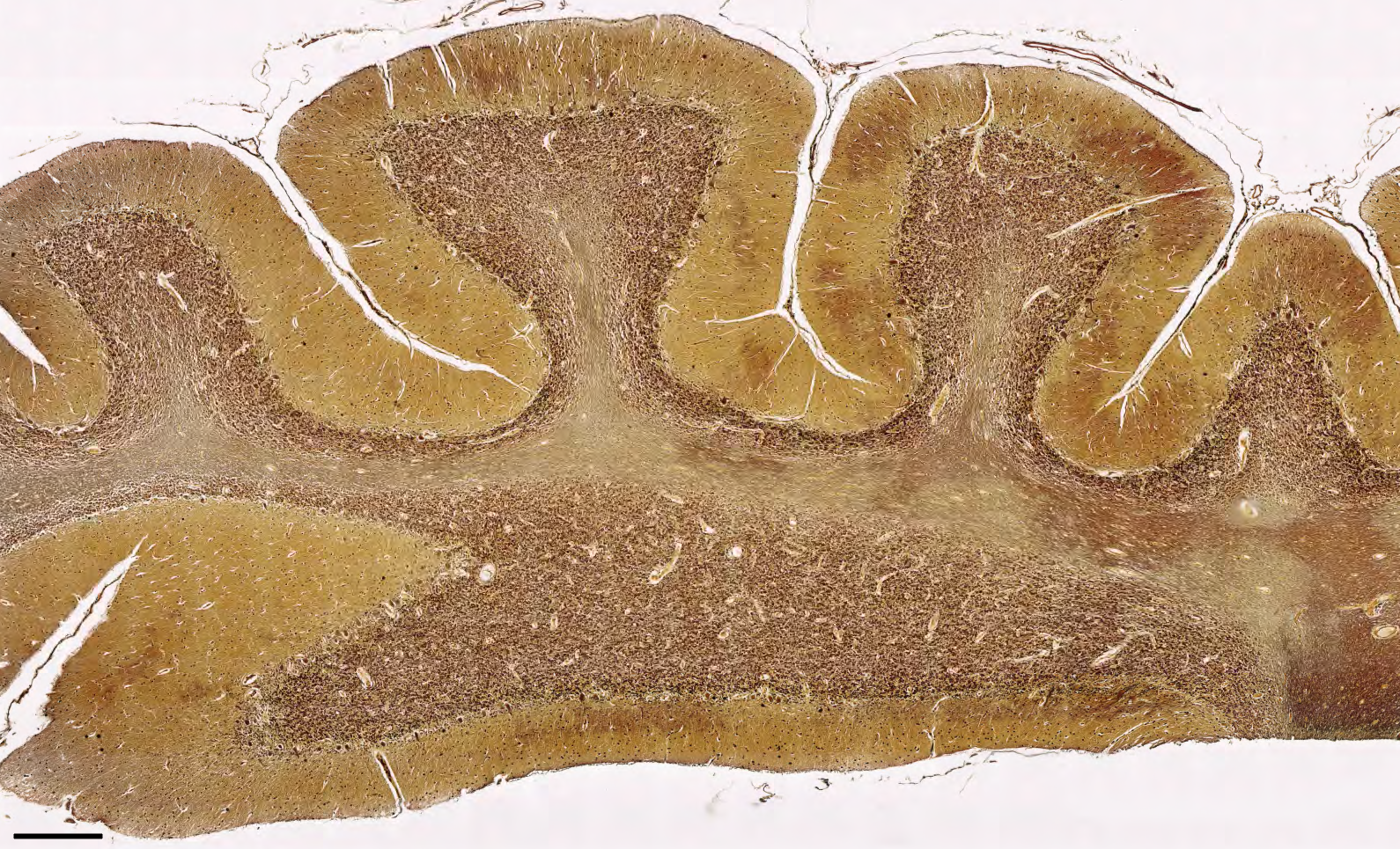 Human cerebellum section with silver stain