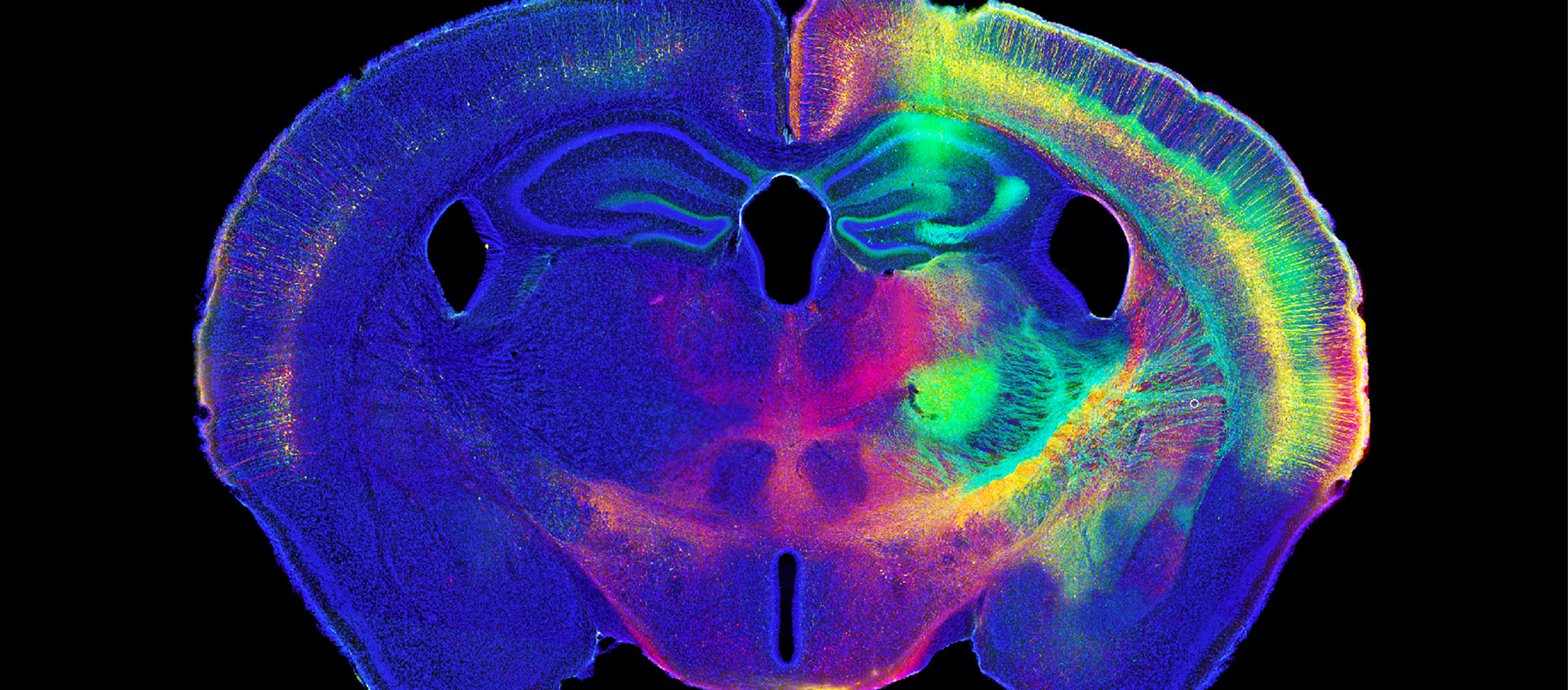 High Resolution scan of brain