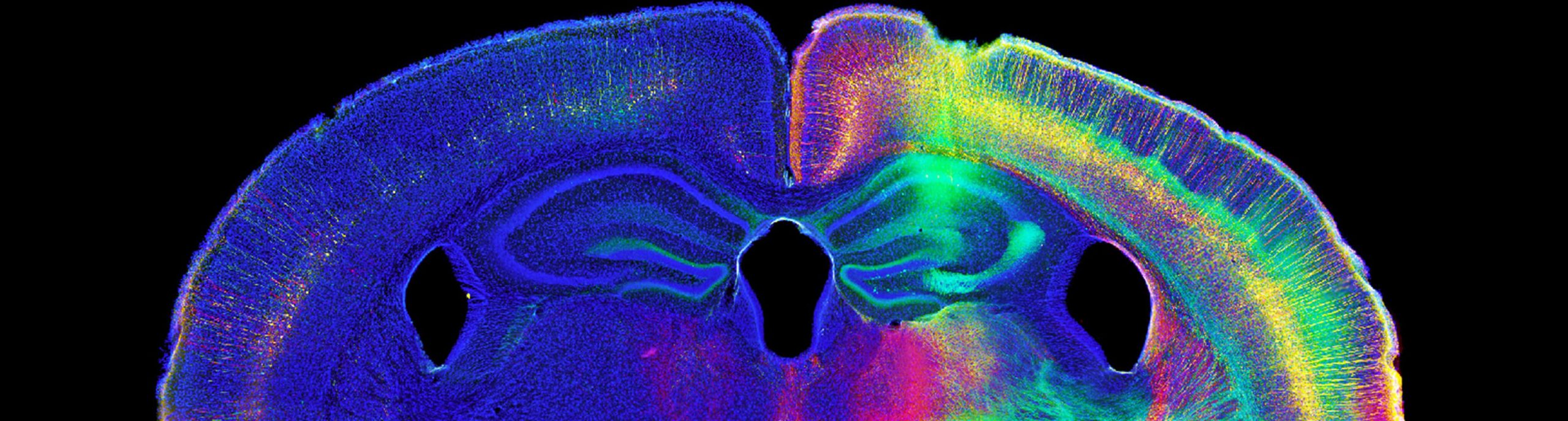 NeurolucidaÂ® Citations - MBF Bioscience