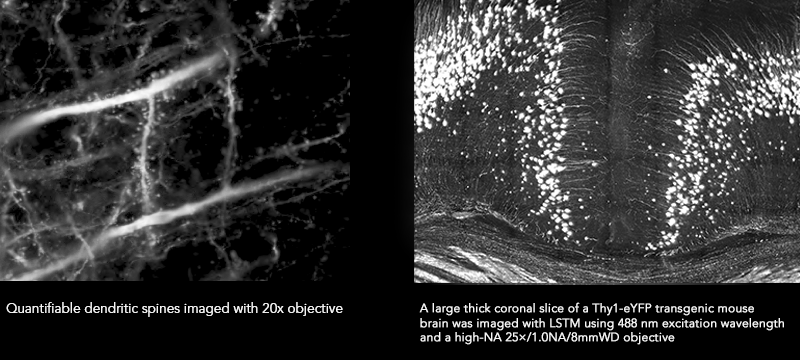 This image shows a mouse brain images with light sheet theta microscope called ClearedScope.