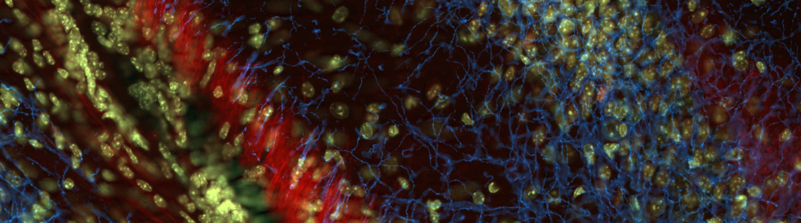 Neurolucida Mbf Bioscience