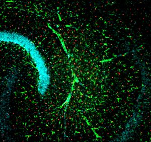 Hippocampus Mouse Brain Section