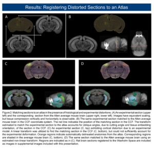 This is a NeuroInfo poster