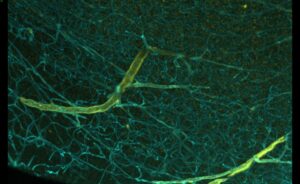 Human Brain Vasculature