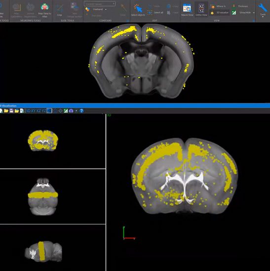 NeuroInfo Video Intro-Image