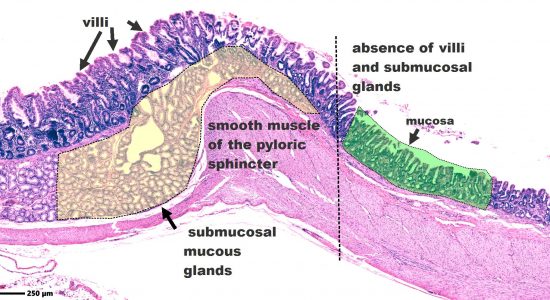 Stomach pylorus and duodenum _zoomed