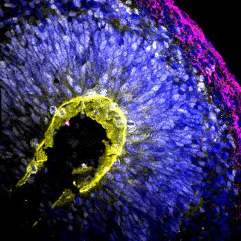 Ventricle like structure within a cortical organoid 40x Confocal Image
